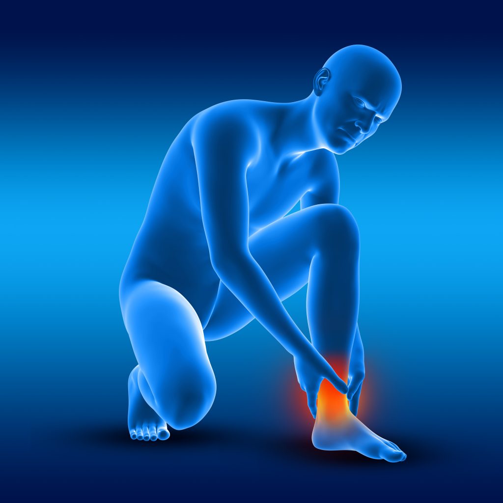 3D render of a male medical figure holding his ankle in pain